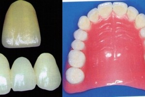 Protetyka zębów w ramach NFZ