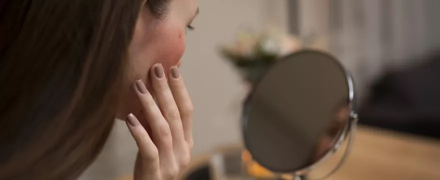 Zaczerwienienie na twarzy – przyczyny i sposoby łagodzenia